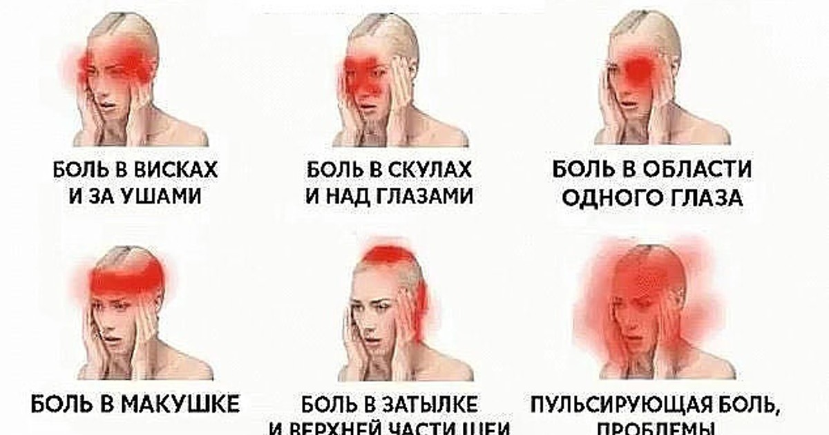 Давящие боли в области глаза. Причины головной боли. Головная боль локализация. Виды головной. Головная боль части головы.
